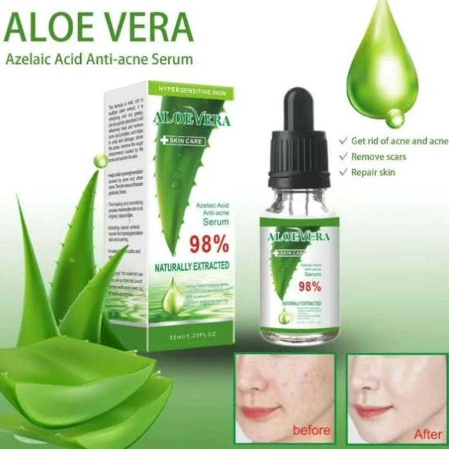 Aloe Vera Serum 98% Pure – Cuidado Intensivo para Pieles Muy Sensibles 🌱💧